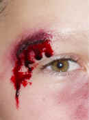 Special Effects: Close up of boy's right eye showing an apparently severe cut on the right eyebrow with synthetic blood oozing from it. Casualty simulation of this nature is employed for both practical first aid training and in theatrical makeup. Television, theatre and the film industry use our techniques. For medical training Cool Faces can provide realistic artificial burns, cuts, grazes and other injuries, as required.